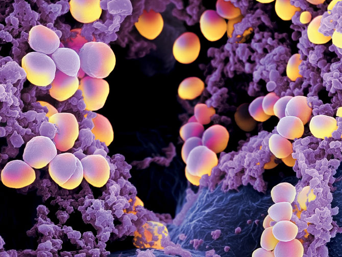 staphylococcus-aureus-food-poisoning-lawyers