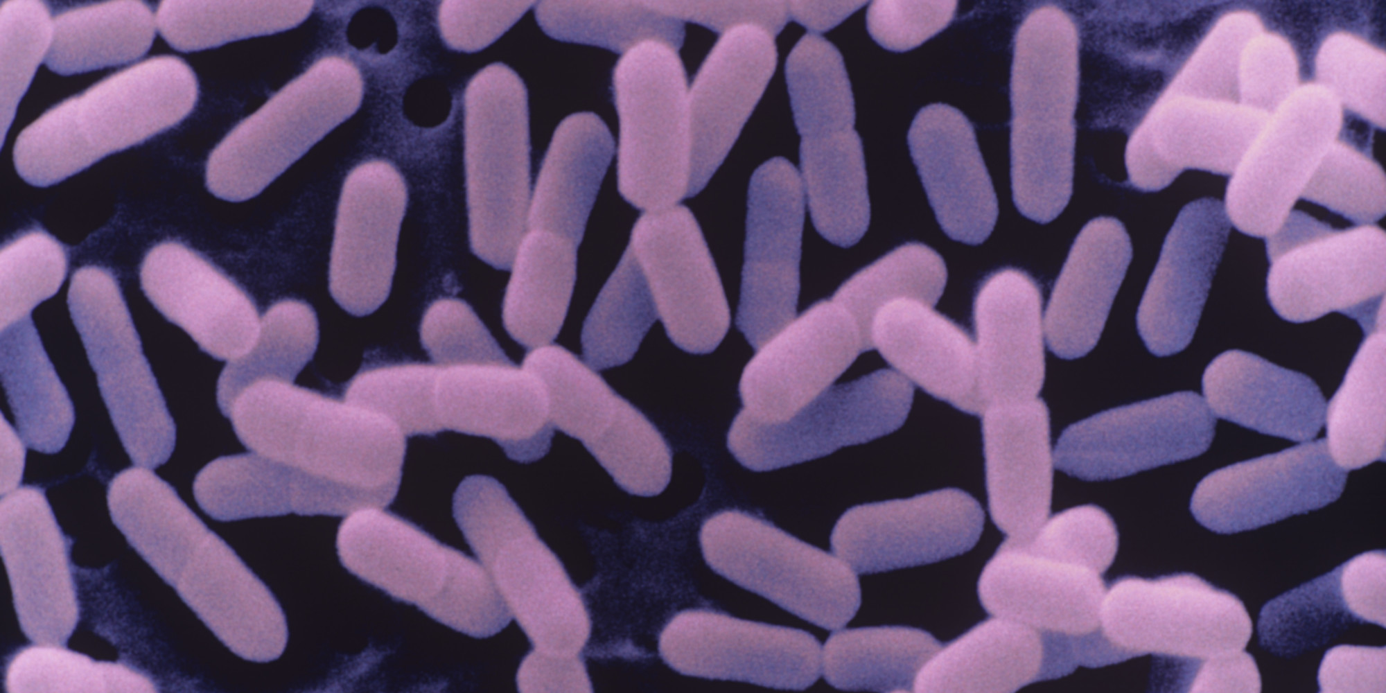 What Illness Does Listeria Cause